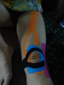 Medical taping